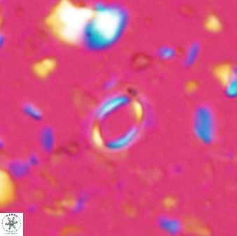 Tenebrislaminam detectus 27919