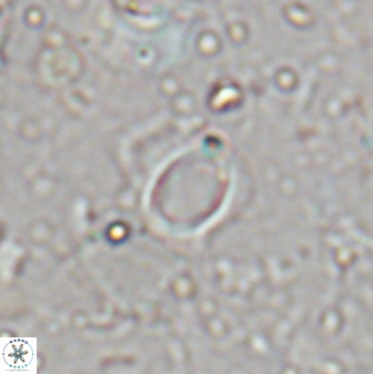Tenebrislaminam detectus 27920