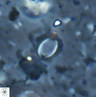 Tenebrislaminam detectus 27921