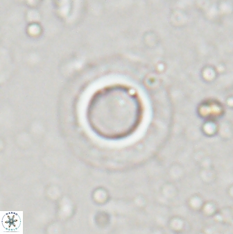 Tenebrislaminam eaquiscutum 29839