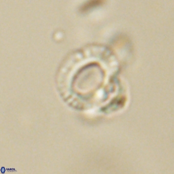Tenebrolamina annula 67415