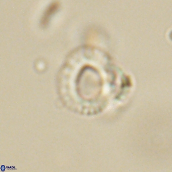 Tenebrolamina annula 67416
