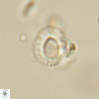 Tenebrolamina annula 67416