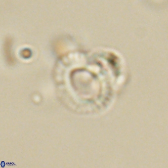 Tenebrolamina annula 67417