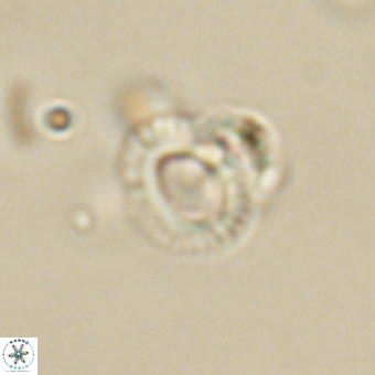 Tenebrolamina annula 67417
