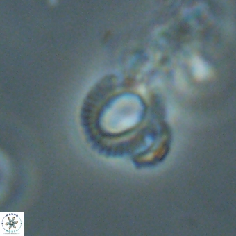 Tenebrolamina annula 67420