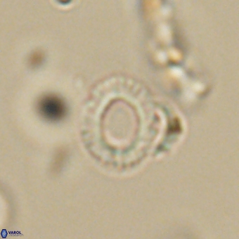 Tenebrolamina annula 67430