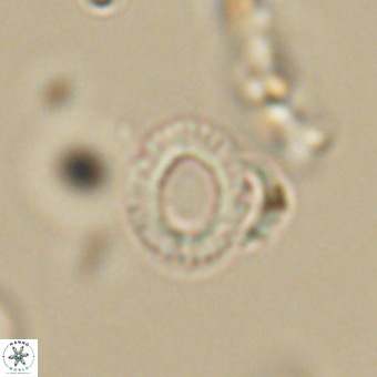 Tenebrolamina annula 67430