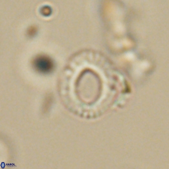 Tenebrolamina annula 67431