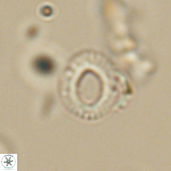 Tenebrolamina annula 67431