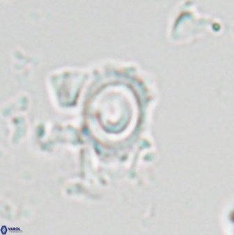 Tenebrolamina annula 22645