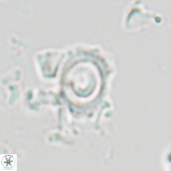 Tenebrolamina annula 22645