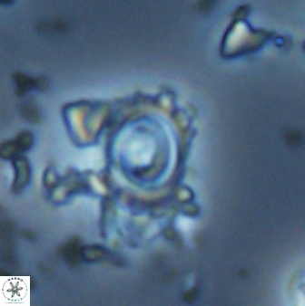 Tenebrolamina annula 22646