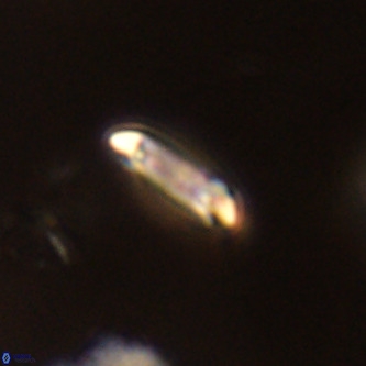 Tenebrolamina annula VR 01145