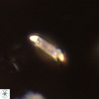 Tenebrolamina annula VR 01145