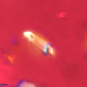 Tenebrolamina annula VR 01146
