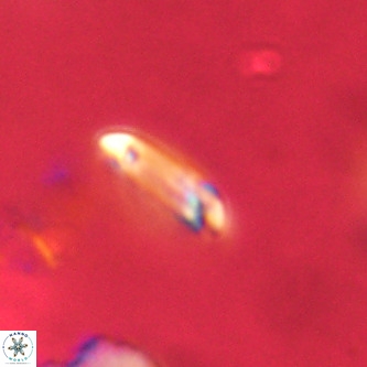 Tenebrolamina annula VR 01146
