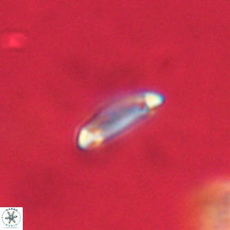 Tenebrolamina annula VR 01150