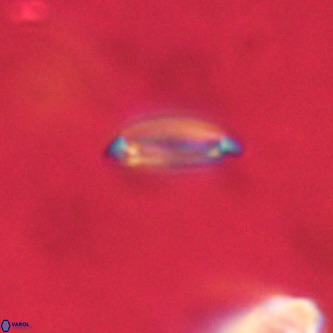 Tenebrolamina annula VR 01151