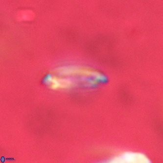 Tenebrolamina annula VR 01154