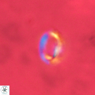 Tenebrolamina annula VR 01158