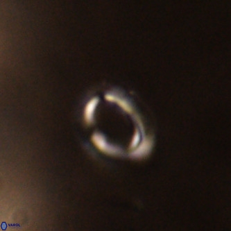 Tenebrolamina annula VR 01160