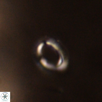 Tenebrolamina annula VR 01160