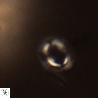 Tenebrolamina annula VR 01161