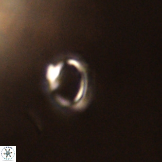 Tenebrolamina annula VR 01165