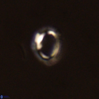 Tenebrolamina annula VR 01166
