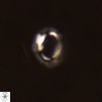 Tenebrolamina annula VR 01166