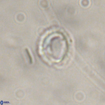 Tenebrolamina annula VR 01168