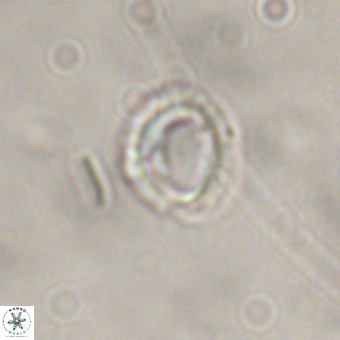 Tenebrolamina annula VR 01168