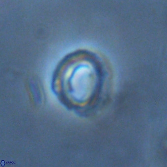 Tenebrolamina annula VR 01169
