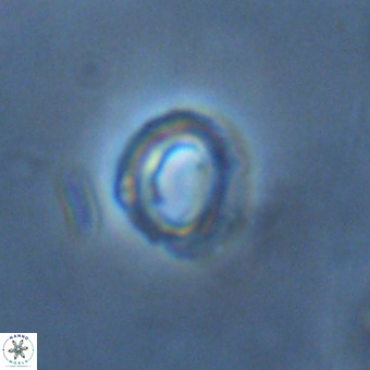 Tenebrolamina annula VR 01169