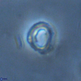Tenebrolamina annula VR 01170