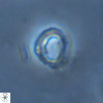 Tenebrolamina annula VR 01170