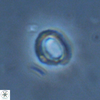Tenebrolamina annula VR 01171