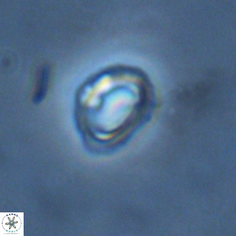 Tenebrolamina annula VR 01172
