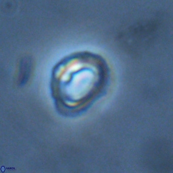 Tenebrolamina annula VR 01173