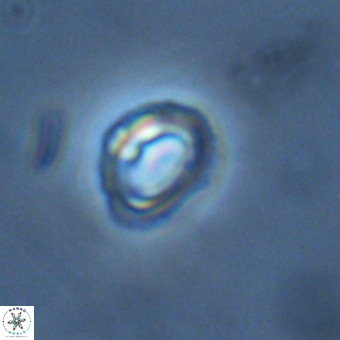 Tenebrolamina annula VR 01173