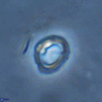 Tenebrolamina annula VR 01174