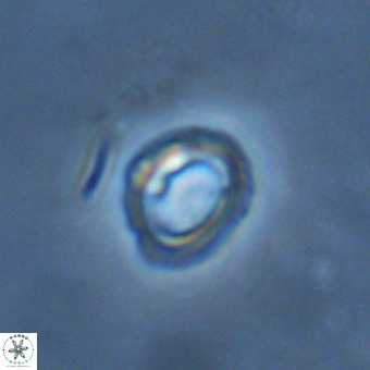 Tenebrolamina annula VR 01174