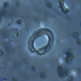 Tenebrolamina edgariae 43083