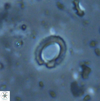 Tenebrolamina edgariae 43083