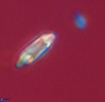Tenebrolamina gibbsiae VR 33059