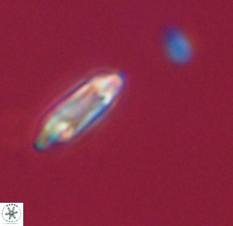 Tenebrolamina gibbsiae VR 33059