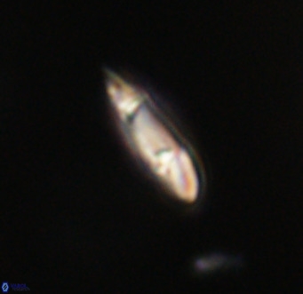 Tenebrolamina gibbsiae VR 33052