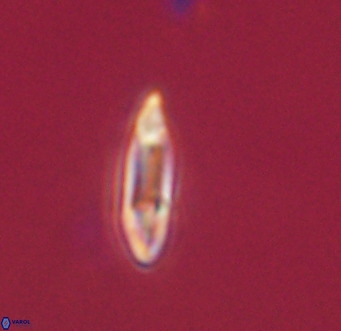 Tenebrolamina gibbsiae VR 33064