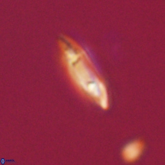 Tenebrolamina gibbsiae VR 33068